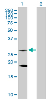 CLTB purified MaxPab rabbit polyclonal antibody (D01P)