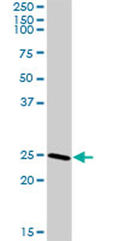 CLTB MaxPab rabbit polyclonal antibody (D01)