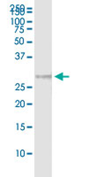 CLTB MaxPab rabbit polyclonal antibody (D01)