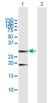 CLTB MaxPab rabbit polyclonal antibody (D01)
