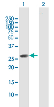 CLTB purified MaxPab mouse polyclonal antibody (B01P)