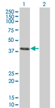 CLN3 monoclonal antibody (M03), clone 1G10
