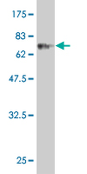 CLN3 monoclonal antibody (M03), clone 1G10