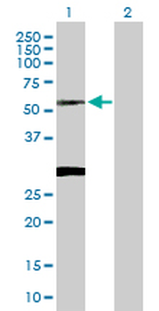 CLN3 purified MaxPab rabbit polyclonal antibody (D01P)