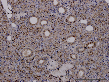 TPP1 monoclonal antibody (M01J), clone 3B1