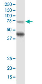 TPP1 monoclonal antibody (M01J), clone 3B1