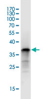 TPP1 monoclonal antibody (M01J), clone 3B1