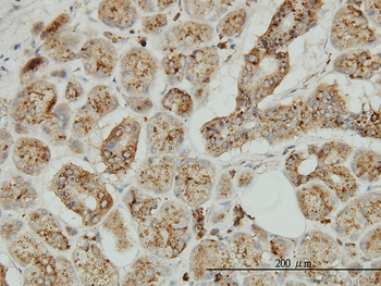TPP1 monoclonal antibody (M01), clone 3B1