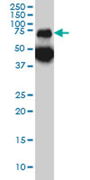 TPP1 monoclonal antibody (M01), clone 3B1