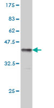 TPP1 monoclonal antibody (M01), clone 3B1