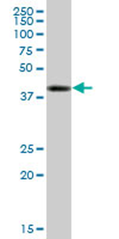 TPP1 purified MaxPab mouse polyclonal antibody (B01P)