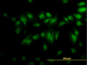 CLK3 monoclonal antibody (M05), clone 1F10