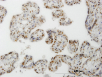 CLK3 monoclonal antibody (M05), clone 1F10