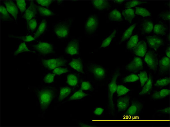 CLK3 monoclonal antibody (M04), clone 5B2