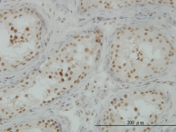 CLK3 monoclonal antibody (M04), clone 5B2