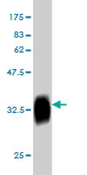 CLK3 monoclonal antibody (M04), clone 5B2