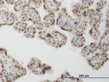 CLK3 monoclonal antibody (M01), clone 1H2