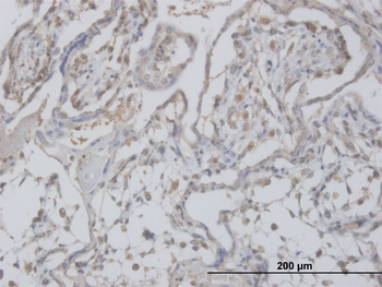 CLIC1 monoclonal antibody (M02), clone 3F9