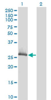 CLIC1 monoclonal antibody (M02), clone 3F9