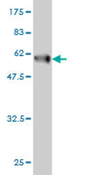 CLIC1 monoclonal antibody (M02), clone 3F9