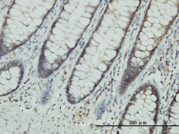 CLIC1 monoclonal antibody (M01J), clone 2D4