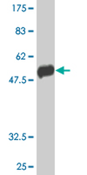 CLIC1 monoclonal antibody (M01J), clone 2D4