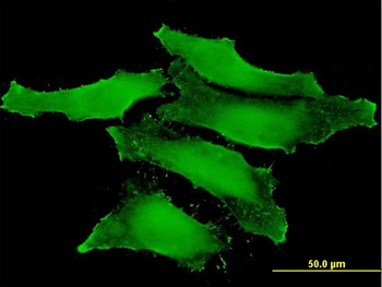 CLIC1 monoclonal antibody (M01), clone 2D4