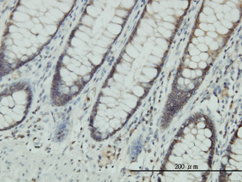 CLIC1 monoclonal antibody (M01), clone 2D4