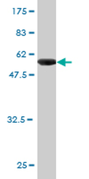 CLIC1 monoclonal antibody (M01), clone 2D4