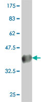 CLCN7 polyclonal antibody (A01)