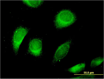 CLCN6 monoclonal antibody (M05), clone 2H2