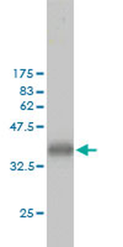 CKS1B monoclonal antibody (M01), clone 3G8