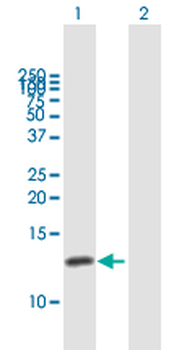 CKS1B purified MaxPab mouse polyclonal antibody (B01P)
