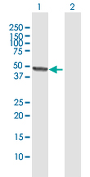 ERCC8 MaxPab rabbit polyclonal antibody (D01)