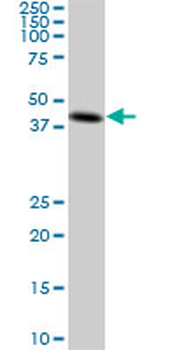 CKMT1B monoclonal antibody (M04), clone 2C8