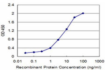 CKMT1B monoclonal antibody (M04), clone 2C8