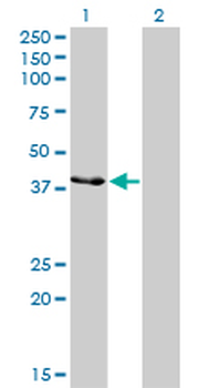 CKMT1B monoclonal antibody (M04), clone 2C8