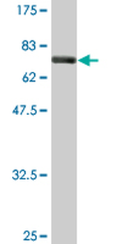 CKM monoclonal antibody (M01A), clone 3E1-F3