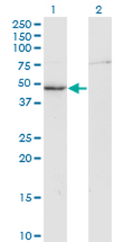 CKM monoclonal antibody (M01), clone 3E1-F3