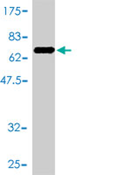 CKM monoclonal antibody (M01), clone 3E1-F3