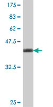 TBCB polyclonal antibody (A01)