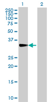 CISH purified MaxPab rabbit polyclonal antibody (D01P)