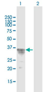 CISH purified MaxPab mouse polyclonal antibody (B01P)