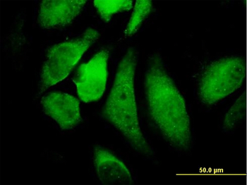 CHUK monoclonal antibody (M04), clone 2G4