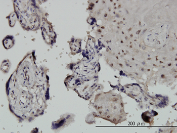 CHUK monoclonal antibody (M04), clone 2G4
