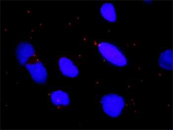 CHUK monoclonal antibody (M04), clone 2G4