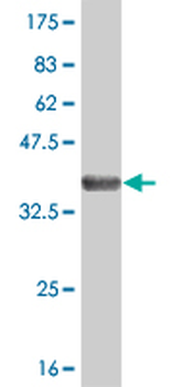 CHUK monoclonal antibody (M04), clone 2G4