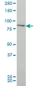 CHUK monoclonal antibody (M03), clone 4B8