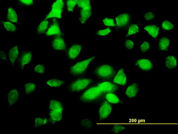 CHUK monoclonal antibody (M03), clone 4B8