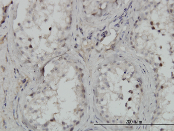 CHUK monoclonal antibody (M03), clone 4B8